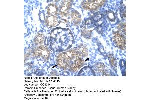Human kidney (TRIM15 anticorps  (N-Term))