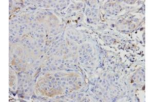 IHC-P Image Immunohistochemical analysis of paraffin-embedded Cal27 xenograft, using ARAF, antibody at 1:500 dilution.
