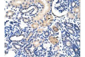 anti-EMG1 Nucleolar Protein Homolog (EMG1) (AA 51-100) antibody