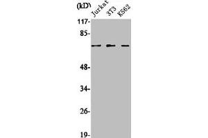 Western Blot analysis of Jurkat NIH-3T3 K562 cells using SENP1 Polyclonal Antibody (SENP1 anticorps  (N-Term))