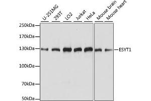 Western blot analysis of extracts of various cell lines, using ESYT1 antibody (ABIN7267069) at 1:1000 dilution. (ESYT1 anticorps  (AA 90-220))