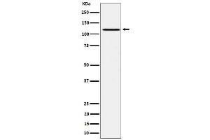 Western blot analysis of Phospho-JAK1 ( + ) expression in Ramos treated with pervanadate cell lysate.