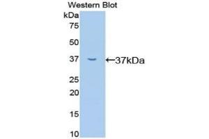 Detection of Recombinant RELA, Mouse using Polyclonal Antibody to Transcription Factor P65 (NFKB3)