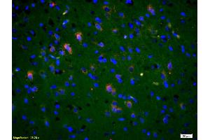 Formalin-fixed and paraffin-embedded rat brain labeled with Anti-Phospho-NMDAR2B (Tyr1336) Polyclonal Antibody, Unconjugated (ABIN801228) 1:200, overnight at 4°C, The secondary antibody was Goat Anti-Rabbit IgG, Cy3 conjugated used at 1:200 dilution for 40 minutes at 37°C.