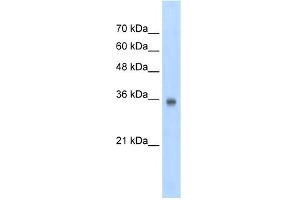 WB Suggested Anti-SOX2 Antibody Titration:  2. (SOX2 anticorps  (N-Term))