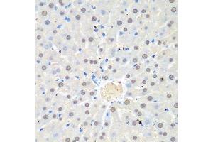 Immunohistochemistry of paraffin-embedded rat liver using WDR48 antibody. (WDR48 anticorps  (AA 450-677))