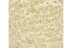 Immunohistochemistry of paraffin-embedded human liver tissue using ABIN7158418 at dilution of 1:100 (LPPR2 anticorps  (AA 1-156))
