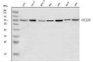 Western blot analysis of CDC25B using anti-CDC25B antibody (ABIN7599434).