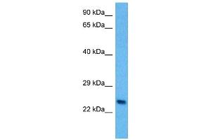 Host:  Mouse  Target Name:  PLP1  Sample Tissue:  Mouse Spleen  Antibody Dilution:  1ug/ml (PLP1 anticorps  (N-Term))