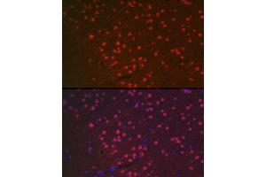 Immunofluorescence analysis of rat brain using [KO Validated] NeuN Rabbit pAb (ABIN3021158, ABIN3021159, ABIN1513254, ABIN1514400 and ABIN6214040) at dilution of 1:100 (40x lens). (NeuN anticorps  (AA 1-220))