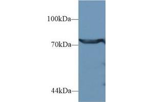 Detection of DPP3 in Human Jurkat cell lysate using Polyclonal Antibody to Dipeptidyl Peptidase 3 (DPP3)