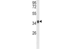 Western Blotting (WB) image for anti-Kruppel-Like Factor 6 (KLF6) antibody (ABIN5022570)