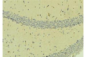 ABIN6278222 at 1/100 staining Mouse brain tissue by IHC-P.