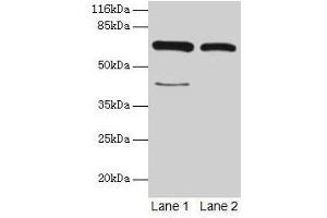 Western blot All lanes: CTPS1 antibody at 6 μg/mL Lane 1: Hela whole cell lysate Lane 2: 293T whole cell lysate Secondary Goat polyclonal to rabbit IgG at 1/10000 dilution Predicted band size: 67, 42 kDa Observed band size: 67 kDa (CTP Synthase anticorps  (AA 300-554))
