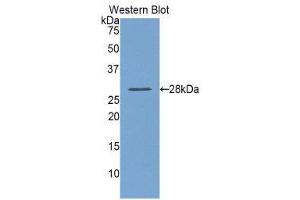 Western Blotting (WB) image for anti-Lysyl Oxidase-Like 1 (LOXL1) (AA 393-603) antibody (ABIN1859683)