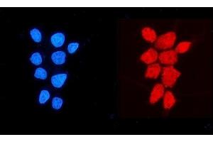 IF analysis of NDUFB5 using anti-NDUFB5 antibody (ABIN7601297).
