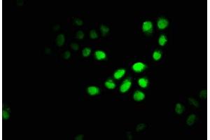 Immunofluorescence staining of Hela cells with ABIN7150950 at 1:100, counter-stained with DAPI. (CBX4 anticorps  (AA 1-160))