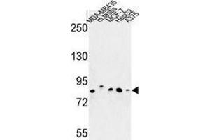 Western blot analysis of CHPF (arrow) in MDA-MB435, MCF-7, HepG2, A375 cell line and mouse testis tissue lysates (35ug/lane) using Chondroitin sulfate synthase 2