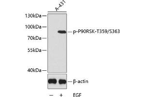 Western blot analysis of extracts of  cells, using Phospho-p90Rsk/RSK1/RPS6K-T359/S363 antibody (ABIN6135276, ABIN6136174, ABIN6136175 and ABIN6225566). (RPS6KA1 anticorps  (pSer363, pThr359))