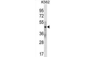 Western Blotting (WB) image for anti-Keratin 33B (KRT33B) antibody (ABIN3000386)