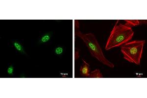 ICC/IF Image XBP1 antibody [N3C3] detects XBP1 protein at nucleus by immunofluorescent analysis. (XBP1 anticorps)