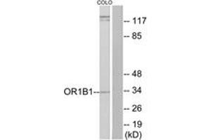 Western blot analysis of extracts from COLO cells, using OR1B1 Antibody. (OR1B1 anticorps  (AA 161-210))