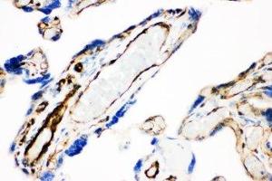 IHC-P: Caveolin-1 antibody testing of human placenta tissue (Caveolin-1 anticorps  (AA 4-178))