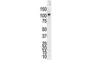 Western blot analysis of PKC nu antibody in lysate of HL-60 cells stimulated with PMA.