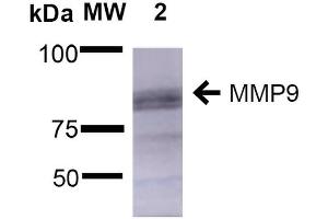 Western Blot analysis of Rat Brain showing detection of ~92 kDa and ~82 kDa (pro and active) MMP9 protein using Mouse Anti-MMP9 Monoclonal Antibody, Clone S51-82 . (MMP 9 anticorps  (AA 1-708) (Atto 488))