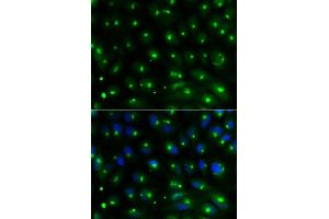 Immunofluorescence analysis of MCF-7 cell using GGA2 antibody. (GGA2 anticorps  (AA 1-300))