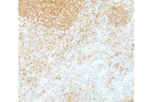 Immunohistochemistry (IHC) image for anti-REL proto-oncogene (c-Rel) (C-Term) antibody (ABIN7795772)