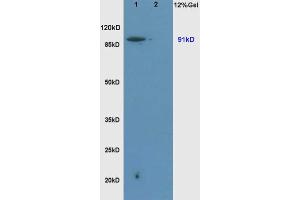 L1 rat brain, L2 rat liver lysates probed  at 1:200 in 4˚C. (SLC9A1 anticorps  (AA 470-550))
