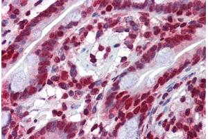 Human Small Intestine: Formalin-Fixed, Paraffin-Embedded (FFPE)