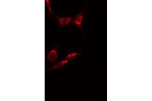 ABIN6278589 staining  HepG2 cells by IF/ICC. (MAK anticorps  (Internal Region))