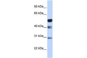 WB Suggested Anti-TFAP2B Antibody Titration:  0. (TFAP2B anticorps  (N-Term))