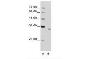 RBM4B anticorps  (AA 290-339)
