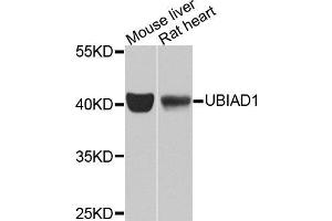 Western blot analysis of extracts of various cell lines, using UBIAD1 antibody (ABIN5975826) at 1/1000 dilution.