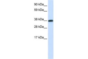 Western Blotting (WB) image for anti-DMRT-Like Family C2 (DMRTC2) antibody (ABIN2461518) (DMRTC2 anticorps)