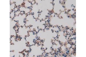 Used in DAB staining on fromalin fixed paraffin- embedded lung tissue (ERP29 anticorps  (AA 42-173))