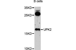 Western blot analysis of extracts of B-cell cells, using UPK2 antibody (ABIN4905559) at 1:1000 dilution. (Uroplakin 2 anticorps)