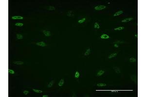 Immunofluorescence of monoclonal antibody to ZBTB33 on HeLa cell. (ZBTB33 anticorps  (AA 564-673))