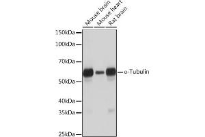 Western blot analysis of extracts of various cell lines, using α-Tubulin Rabbit mAb (ABIN7271036) at 1:1000 dilution. (TUBA4A anticorps)