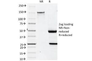 SDS-PAGE Analysis of Purified, BSA-Free Keratin 19 Antibody (clone BA17).