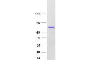 Validation with Western Blot