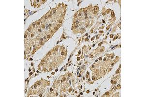 Immunohistochemistry of paraffin-embedded human stomach using XRCC3 antibody at dilution of 1:200 (x400 lens).