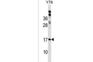 GR1 Antibody (N-term) 18154a western blot analysis in Y79 cell line lysates (35 μg/lane). (GLIPR2 anticorps  (N-Term))
