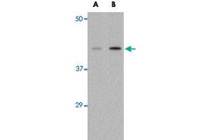 Western blot analysis of AGTR1 in mouse kidney tissue lysate with AGTR1 polyclonal antibody  at (A) 1 and (B) 2 ug/mL .