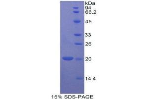SDS-PAGE (SDS) image for BCL2-Like 2 (BCL2L2) (AA 11-171) protein (His tag) (ABIN2120633) (BCL2L2 Protein (AA 11-171) (His tag))