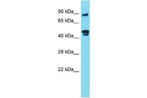 Host: Rabbit Target Name: RSPH4A Sample Type: 721_B Whole Cell lysates Antibody Dilution: 1. (RSPH4A anticorps  (N-Term))
