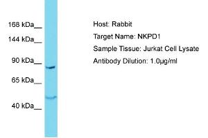 Host: Rabbit Target Name: NKPD1 Sample Type: Jurkat Whole Cell lysates Antibody Dilution: 1. (NKPD1 anticorps  (N-Term))